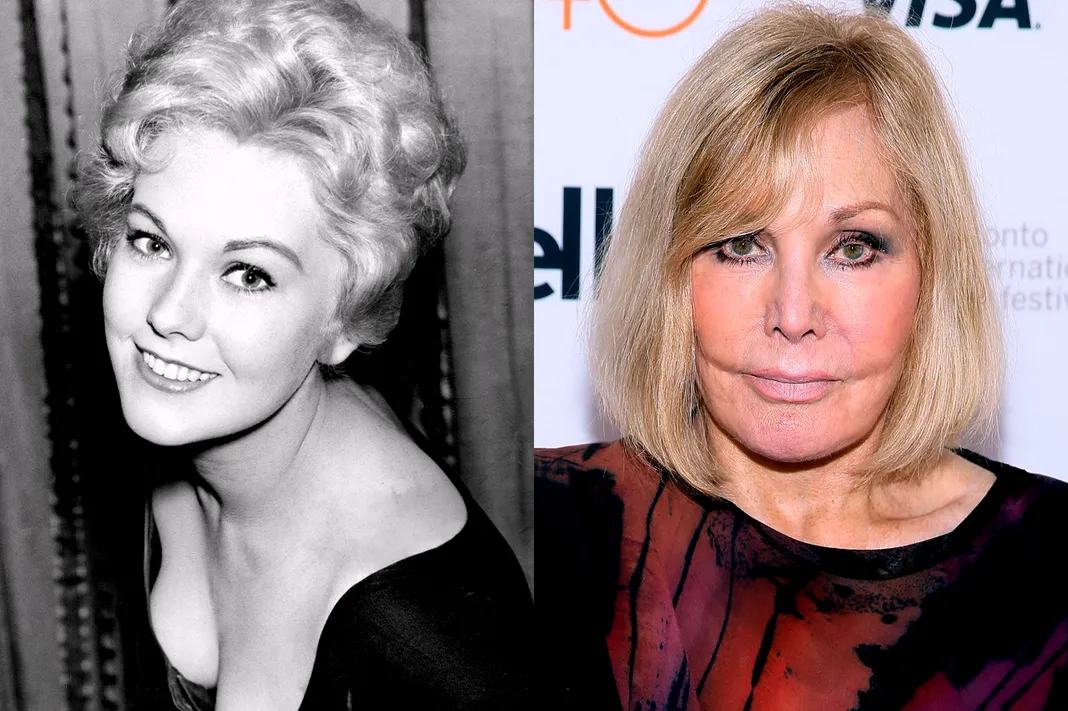 13 Of The Most Drastic Celebrity Plastic Surgeries